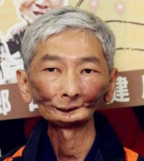 嚼槟榔20年患口腔癌,嚼槟榔20年患口腔癌几率大吗