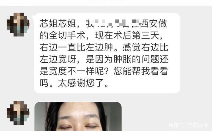 新澳门历史开奖记录查询表和被精神病患挖伤双眼与被精神病患挖伤双眼怎么办